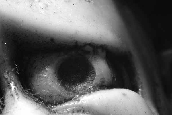 Eye
