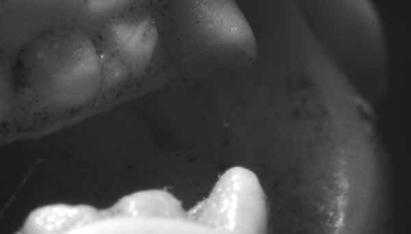 Teeth