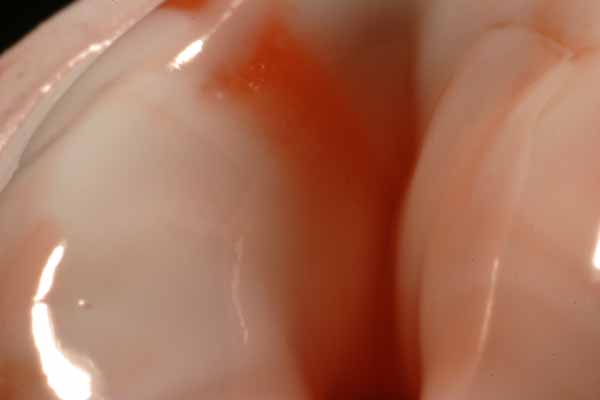 Toothpaste 3
