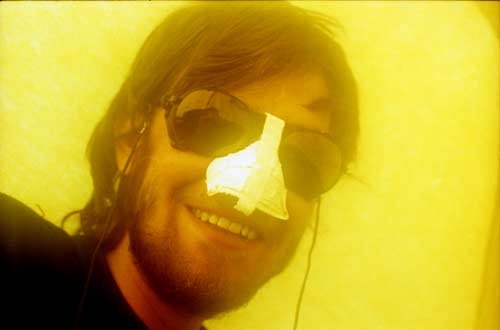 Nose Job at 5500m